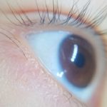 瞼の痙攣の原因と止め方、目薬は原因別に成分で選ぼう！
